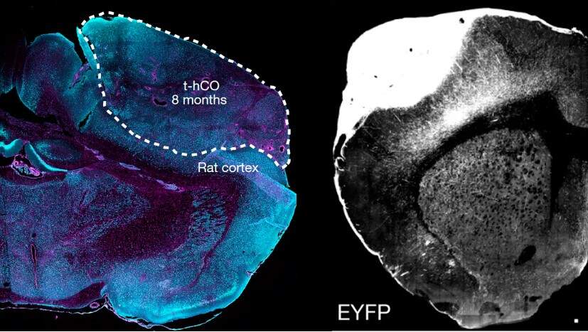 Para estudar doenças neurológicas, pesquisadores criam cérebro híbrido rato-humano